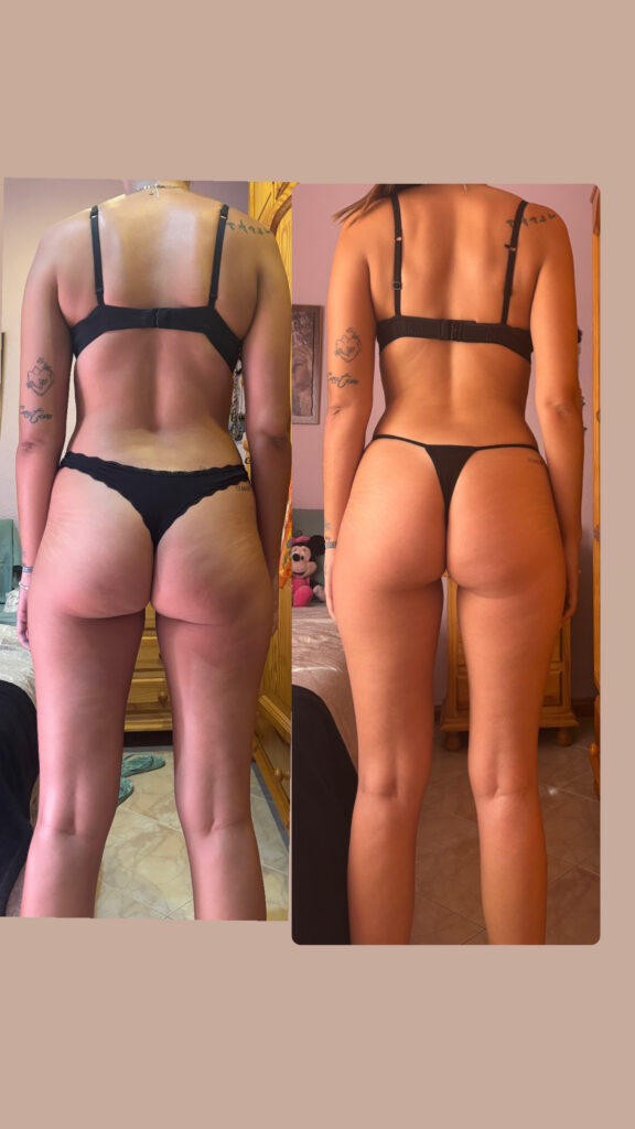 María, 27 años — Espalda